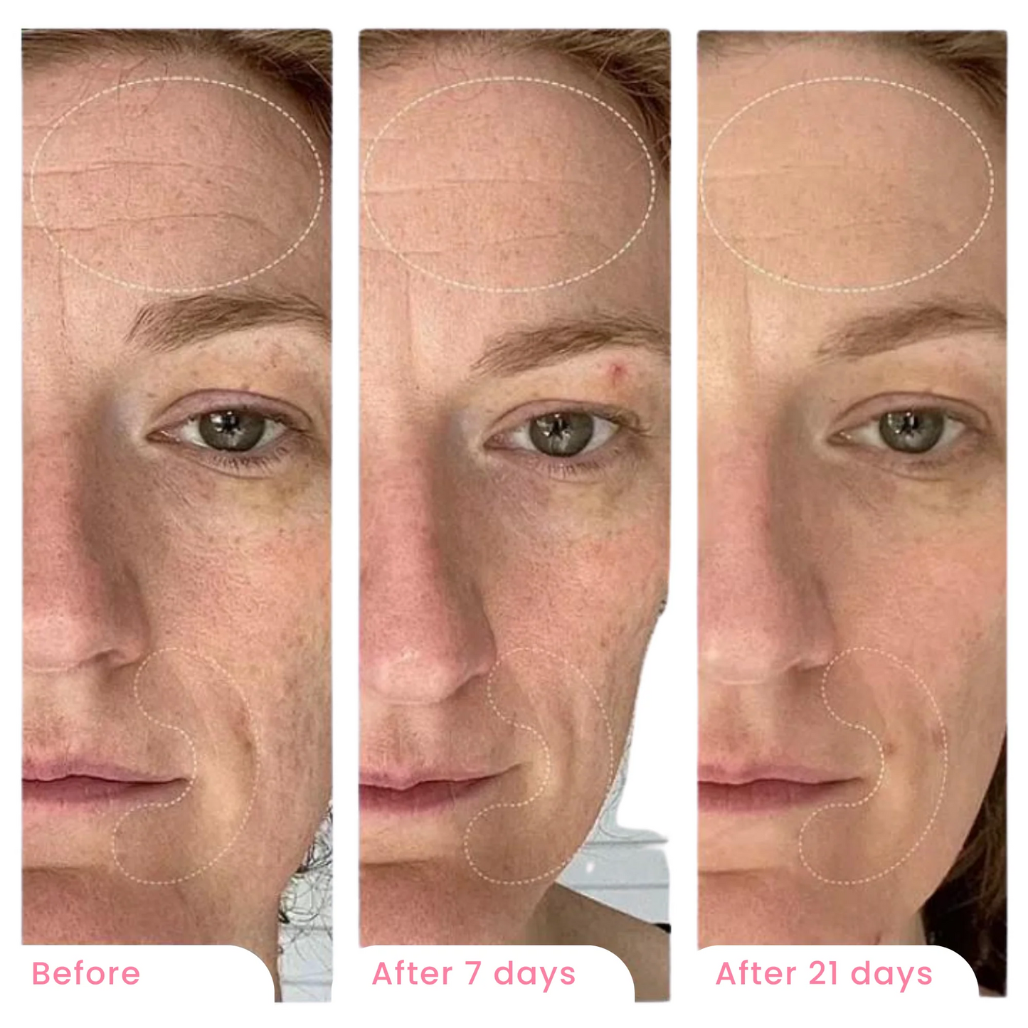 BodyLove - Bio-Collagen Mask