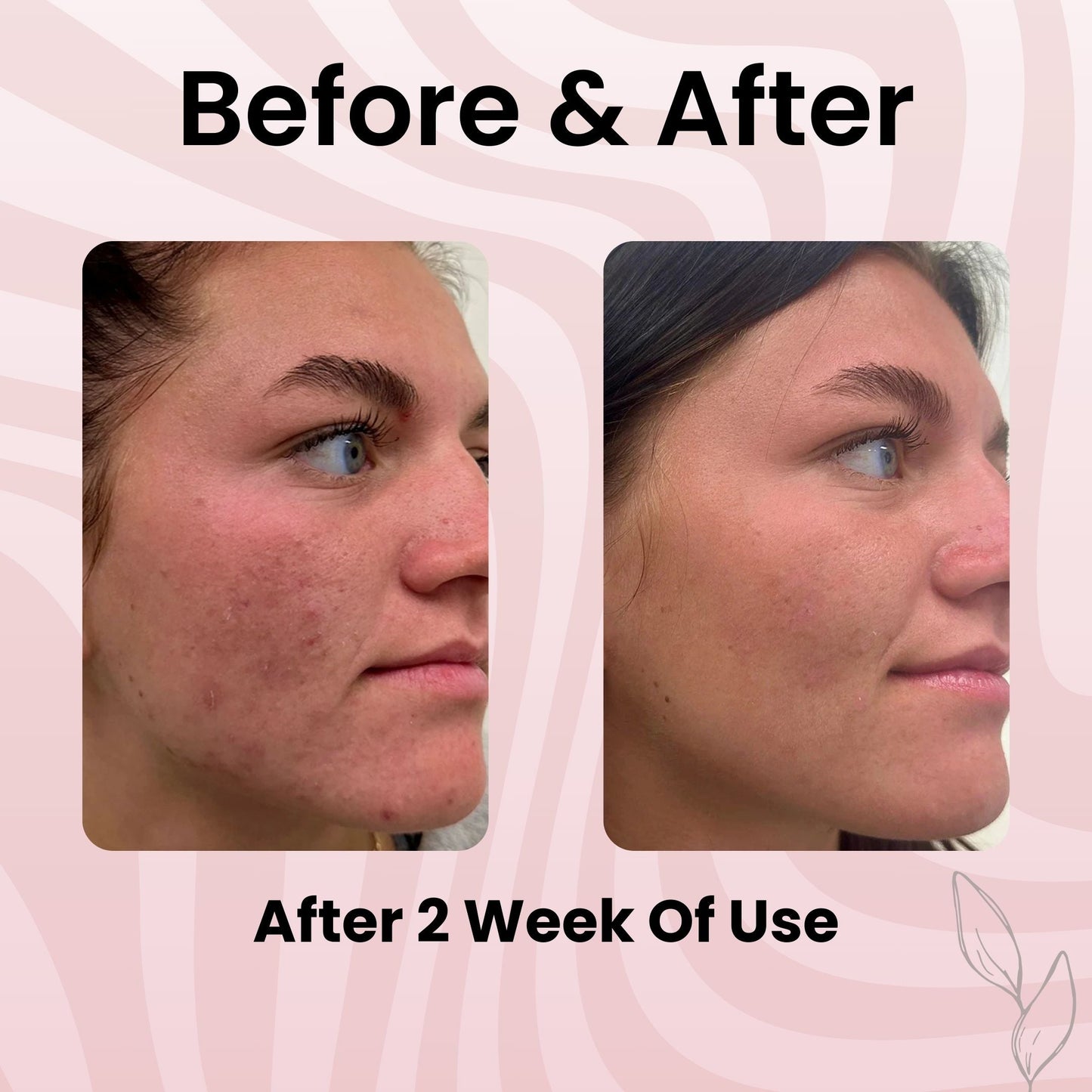 BodyLove - Collagen Night Wrapping Peel Of Mask (BUY1-GET1)