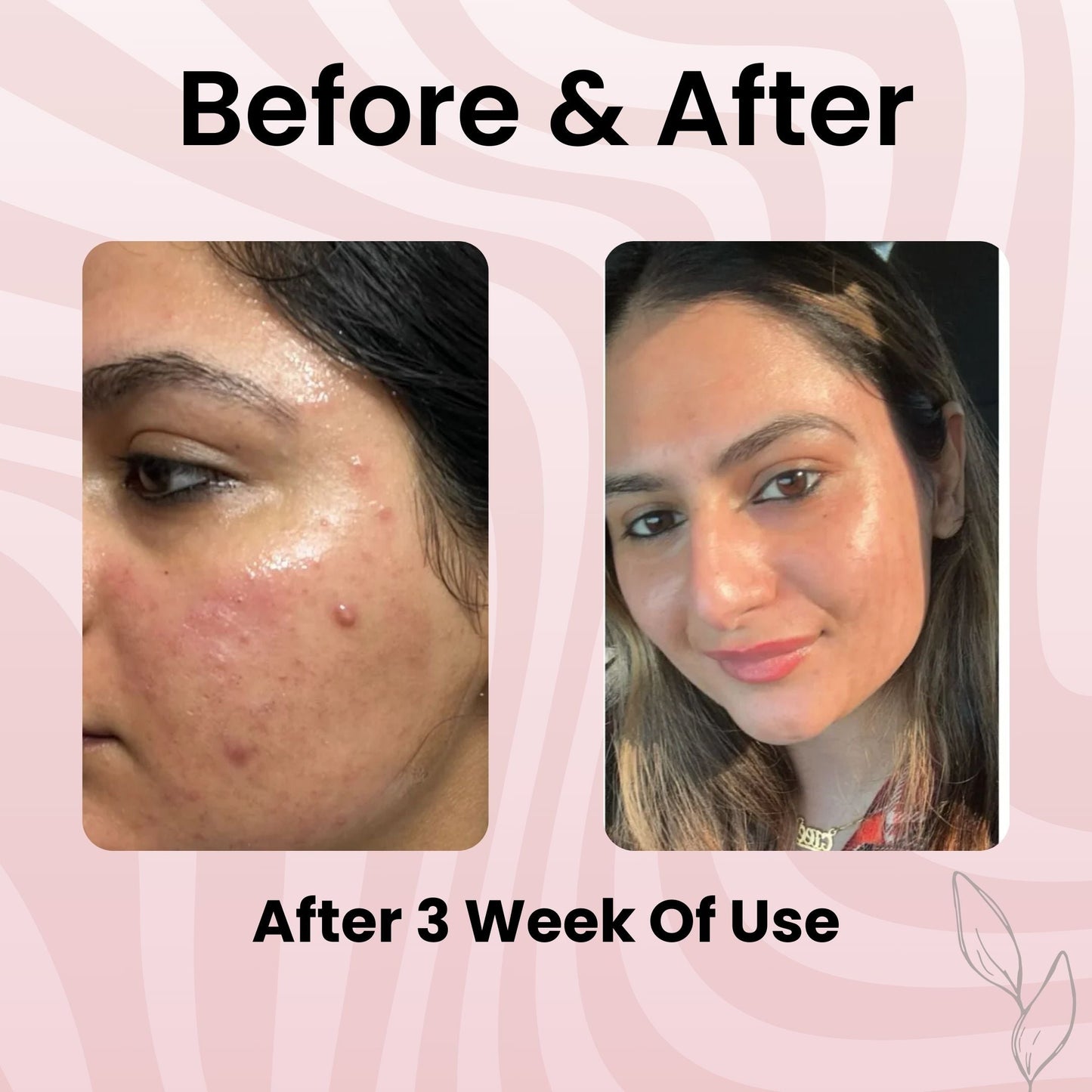 BodyLove - Collagen Night Wrapping Peel Of Mask (BUY1-GET1)