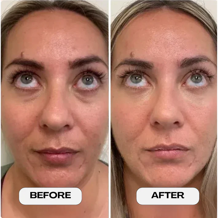 BodyLove - Glow Revival Eye Patch